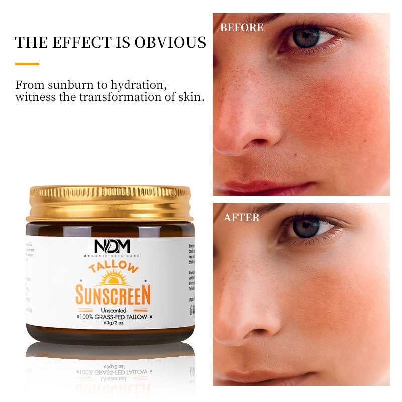 Pre Summer Sale - 100% Organic Grass Fed Beef Tallow Sunscreen